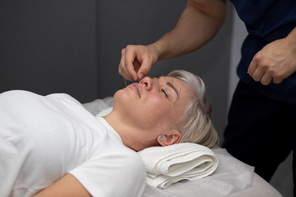 Acupuncture for stress relief